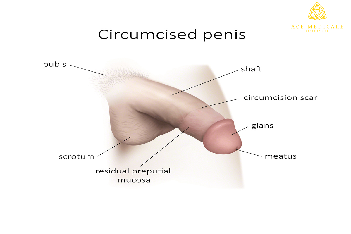 How does male circumcision khatna impact sexual function?